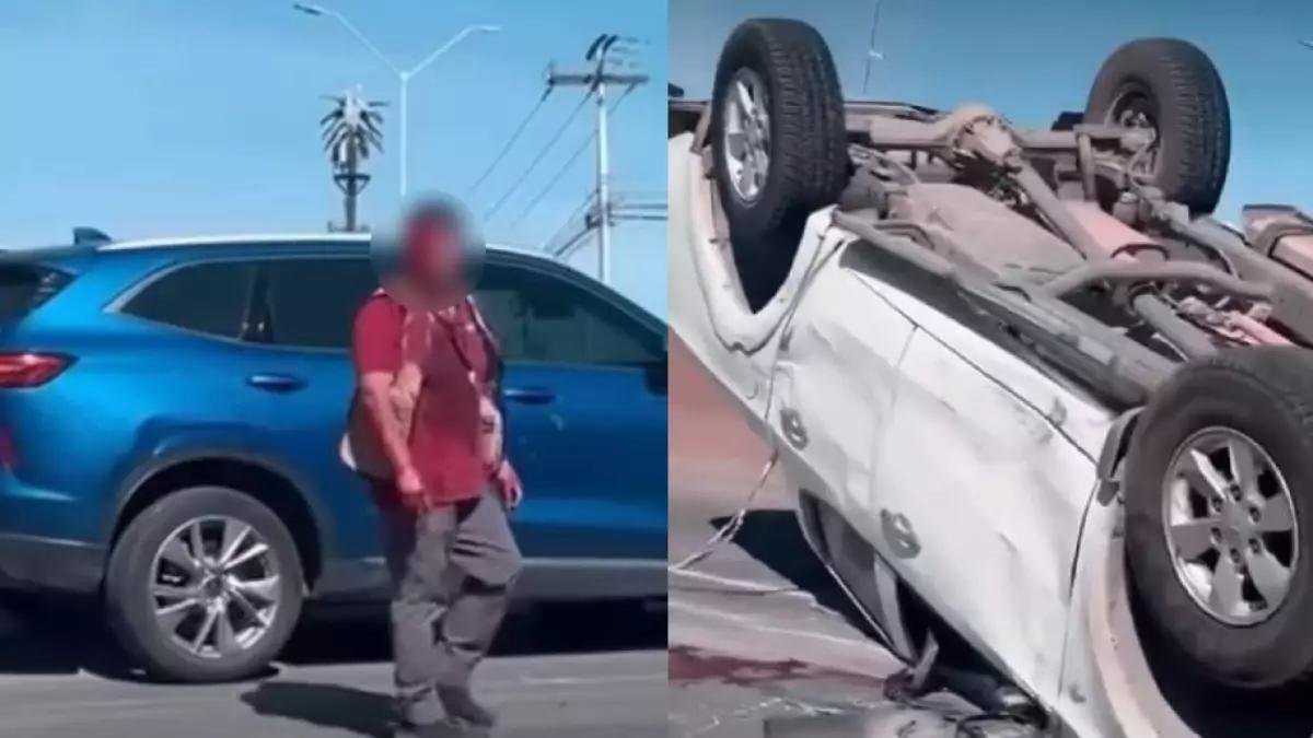 Hombre camina sin la mitad de su cara tras sufrir grave accidente en el Periférico