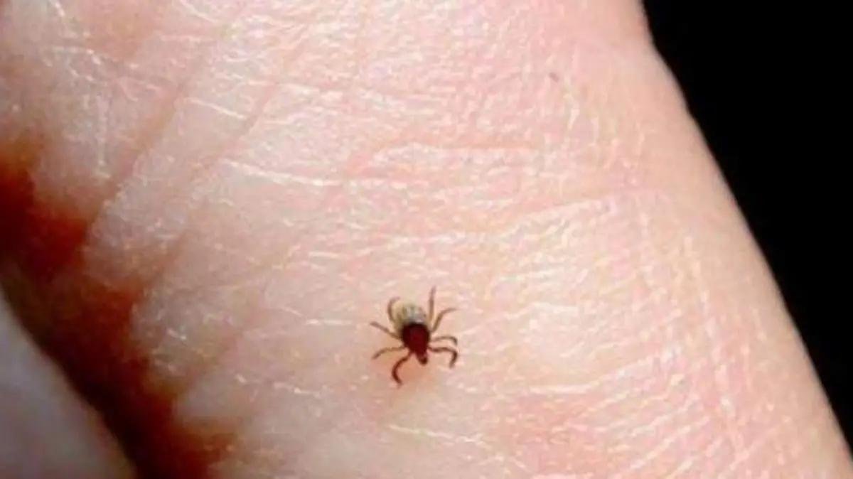 Suma Chihuahua 53 casos de rickettsiosis y 26 defunciones en 2026